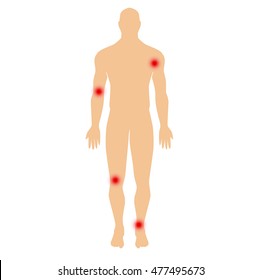  human silhouette on a white background. joint pain, joint diseases, joint infection, pain on movement, inflammation in the joints.Modern Medical vector infographics. Medic anatomy