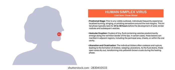 Human simplex virus HSV1 cold sore symptoms on female head profile silhouette with orange banner and detailed text describing prodromal stage, vesicular eruption, and ulceration vector illustration.