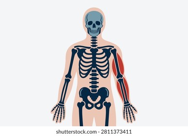 Human skeletal diagram with highlighted red muscles on one arm to illustrate muscular pain strain or anatomical study.