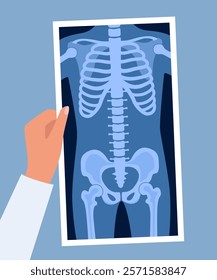 Human skeleton chest x ray image. Torso roentgen shot. Medical analyzing. Anatomical bone medicine laboratory radial scan picture. Roentgen shot in doctors hand. Vector illustration