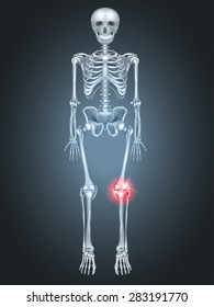 Human Skeleton with knee joint pain on a dark radial background. 