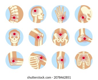 Human Skeleton Pain Points Icon Set Vector Flat Illustration. Chronic Anatomy Body Injury In Circle Shape Isolated On White. Healthcare Medical Studying Educational Acupuncture Scheme. Health Medicine