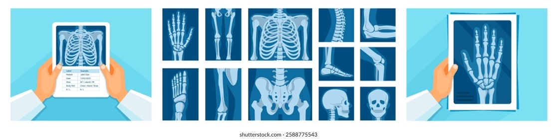 Human skeleton roentgen medical analyzing vector illustration set icon