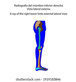 Human skeleton X-ray of the right lower limb external lateral view vector ilustration