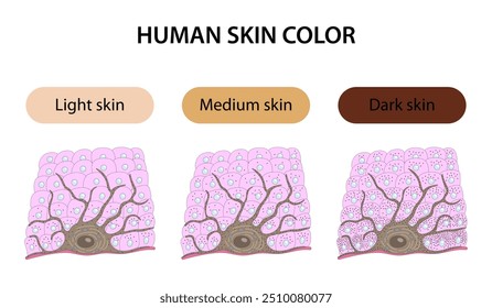 Human skin color: light, medium and dark
