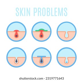 Human skin problems. Acne, black head pores and skin infections flat vector infographic illustration set