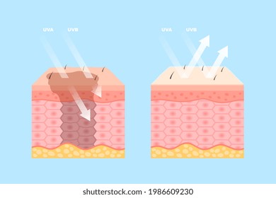 Protección de la piel humana contra el efecto de los rayos ultravioletas. Diseño realista para el paquete de productos cosméticos skincare spf sunscreen. Crema médica con reflexión solar antes y después de aplicar ilustración vectorial