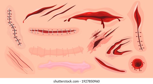 Human skin scars, cuts and bloody wounds flat set for web design. Cartoon ruptures in body tissue isolated vector illustration collection. Injury and traumatology concept