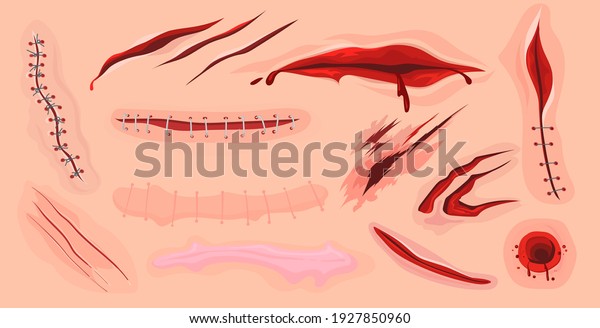 Human skin scars, cuts\
and bloody wounds flat set for web design. Cartoon ruptures in body\
tissue isolated vector illustration collection. Injury and\
traumatology concept