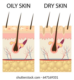 1,382 Dry skin anatomy Images, Stock Photos & Vectors | Shutterstock