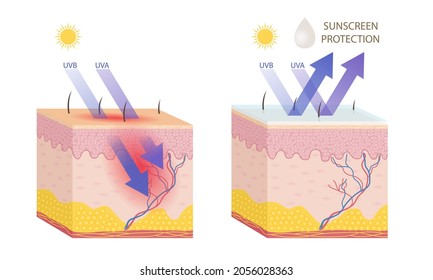 Human skin with and without sunscreen protection on white background.