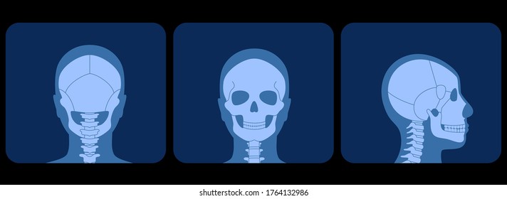 Human skull anatomy in front, profile and back on x ray view. Structure of facial skeleton with main parts. Cranium diagram with part bones. Flat vector medical illustration isolated.