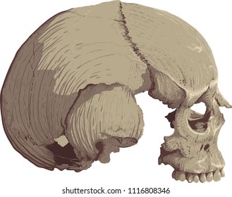 human skull without the lower jaw in profile white painted backgrounds both engraving