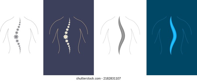 Human Spine Concept Logo Design. Human spine with illness, scoliosis. Vector Illustration. Isolated. EPS 10.