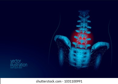 Human spine hip lumbar radiculitis pain low poly. Geometric polygonal particle triangle point line future medicine technology blue red painful area vector illustration