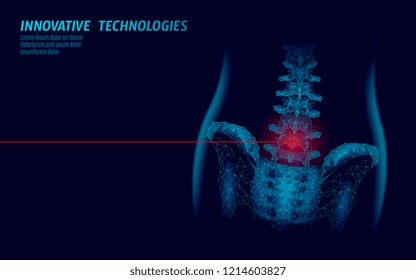 Human spine hip lumbar radiculitis pain low poly. Geometric polygonal particle triangle point line future medicine technology blue red painful area vector illustration