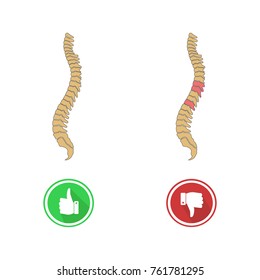 Human Spine, mesh
