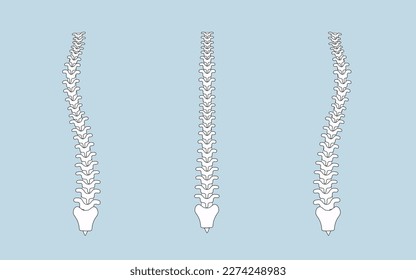 human spine in normal and with scoliosis	