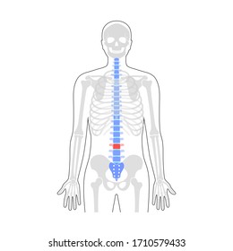 Human spine pain and skeleton vector illustration. Back bone and vertebral column injury. Symbol of spinal surgery, rehabilitation, artritis. Medical, educational and science banner 

