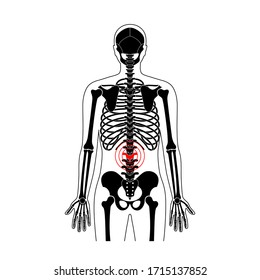 Human spine pain and skeleton vector illustration. Back bone and vertebral column injury. Symbol of spinal surgery, rehabilitation, artritis. Medical, educational and science banner 
