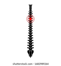 Human spine pain vector illustration. Backbone and vertebral column injury. Symbol of spinal surgery, rehabilitation, artritis. Spinal icon symbol design. Medical, educational and science banner