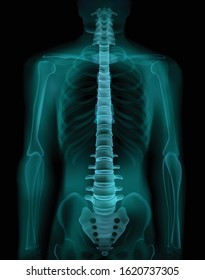 Human spine and pelvis realistic x-ray ct radiography fluoroscopy medical screening  exam image vector illustration 