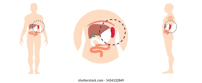 Human Spleen Icons Set. Flat Set Of Human Spleen Vector Icons For Web Design