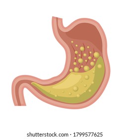 Human stomach. Anatomy, structure of internal organs. Digestive system. Vector illustration