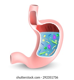 Human Stomach With Bacteria And Other Microbes