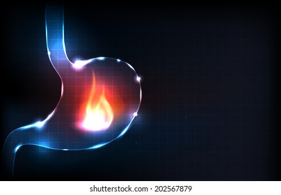 Human stomach burning. Fire in the stomach. Stomach pain concept.