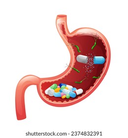 Human stomach with drug capsules, tablets, pills and helicobacter pylori inside. Vector illustration isolated on white background. Cartoon style
