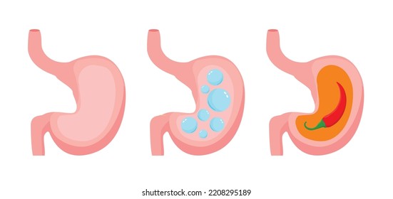 Human Stomach. Empty and full stomach. Bloating. Vector illustration