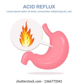 Human Stomach With Fire Sign. Gastroesophageal Acid Reflux Disease. GERD, Heartburn, Gastric Infographic. Vector Flat Design