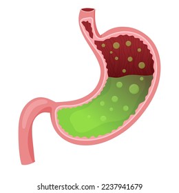 Human stomach full of acid. Vector illustration isolated on white background. Cartoon style
