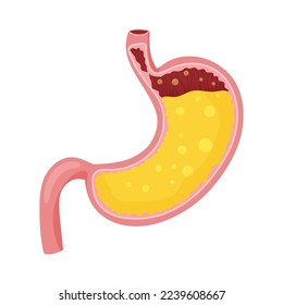 Human stomach full of gastric juice. Vector illustration isolated on white background. Cartoon style

