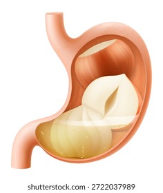 Menschlicher Magen mit Haselnüssen. Der Magen verdaut Haselnüsse. Ein Magen gefüllt mit gesundem Essen mit Eiweiß. Richtige Ernährung. Realistische 3D-Vektorgrafik. Illustration des Lebensmittelverdauungsprozesses