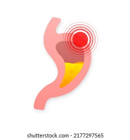 Human stomach. Healthy and unhealthy. Digestive system anatomy. Vector stock illustration.