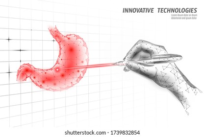 Human stomach laser surgery operation low poly. Medicine disease drug treatment painful area. Red triangles polygonal 3D render shape. Pharmacy business poster template vector illustration