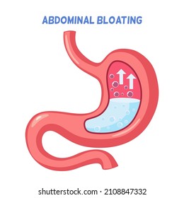 A Human Stomach In Pink Pastel Color Shows Inside, Gas Bloating Stomach And Up Arrows, Belching Gas In Stomach, Human Internal Organs On White Background, Clean Minimal Design 