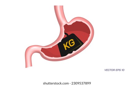 Human stomach problems, Gastrointestinal diseases. Common Digestive Disorders. Poor Digestive conditions. How right medication keep your stomach healthy. Student biology study material images.