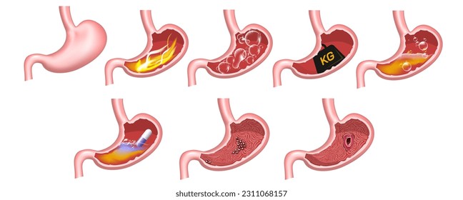 Probleme des menschlichen Magens, Erkrankungen des Gastrointestinaltrakts. Häufig Verdauungsstörungen. Schlechte Verdauungsbedingungen. Wie richtige Medikamente Ihren Magen gesund halten. Studierendenbiologie studiert Materialbilder.