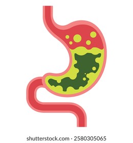 Human stomach vector illustration. Depicts gastritis, acid reflux, indigestion, heartburn, and stomach pain problems. Concept of illness, discomfort, and unhealthy stomach.