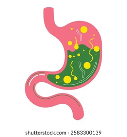 Human stomach vector illustration. Depicts gastritis, acid reflux, indigestion, heartburn, and stomach pain problems. Concept of illness, discomfort, and unhealthy stomach.