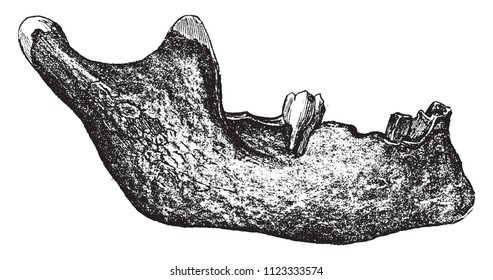 Menschliches Zeug, das Boucher de Perthes in Moulin Quignon bei Abbeville im Jahr 1863 gesammelt hat