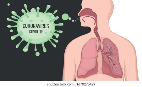 Human symptoms of coronavirus, tuberculosis,  pneumonia, colds. A person infected with a coronavirus. CoVID-19 Virus outbreak spread.