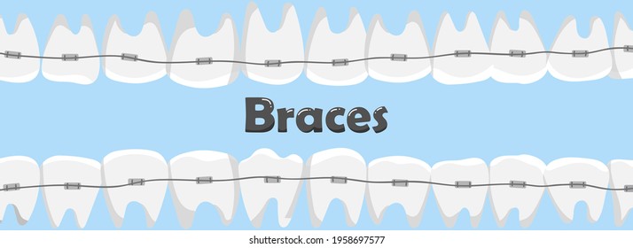 Human teeth with braces. dental care concept.