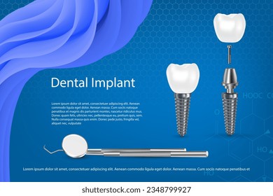 Dientes humanos e Ilustración del vector implante dental.