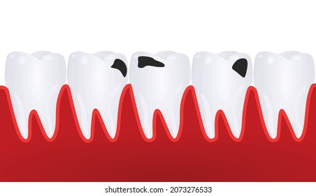 Human teeth isolated. vector illustration