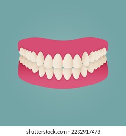 Human teeth malocclusion set with realistic images of mouth jaws with crooked teeth and text captions. Normal and abnormal occlusion. Vector illustration