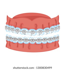 human teeth with orthodontics